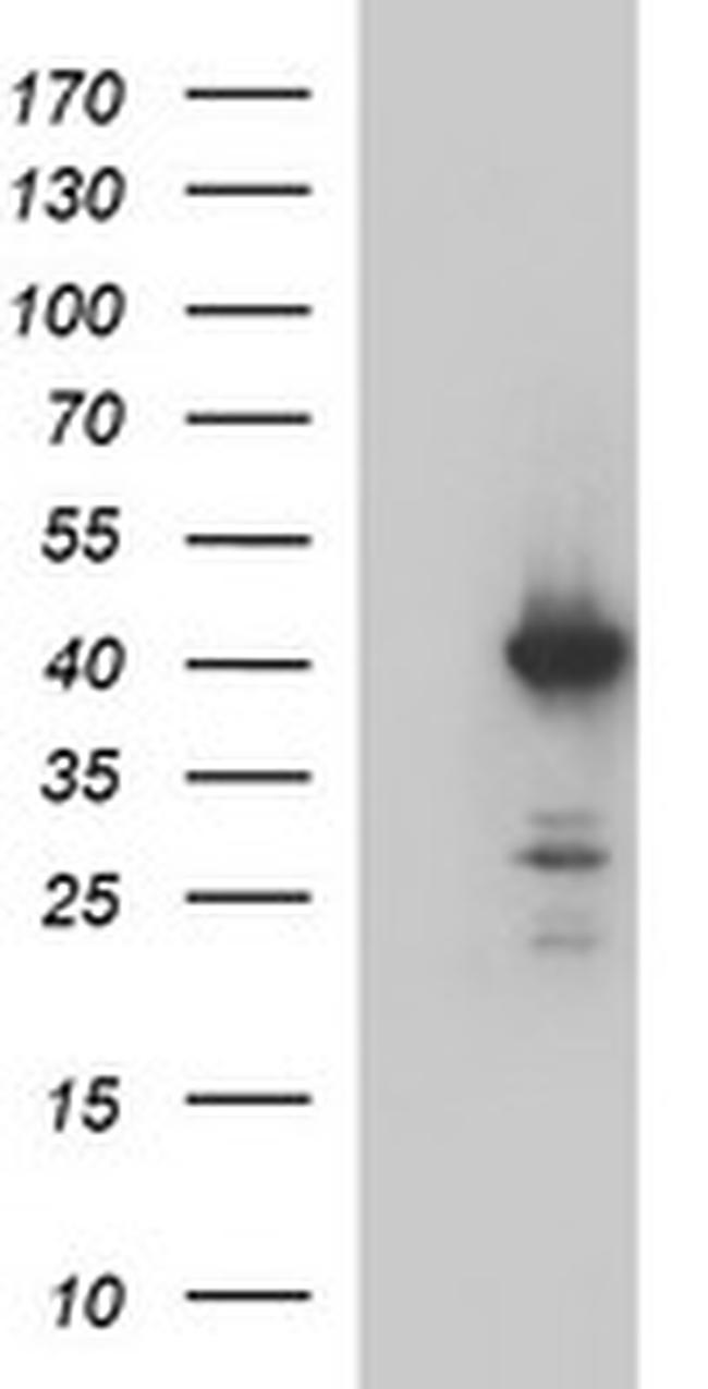 HAUS7 Antibody in Western Blot (WB)