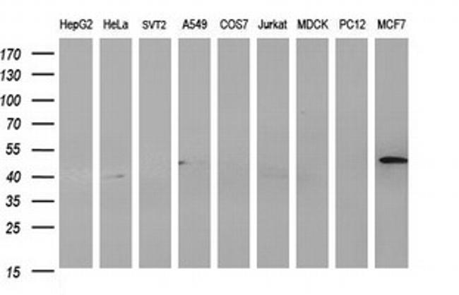 HAUS7 Antibody in Western Blot (WB)