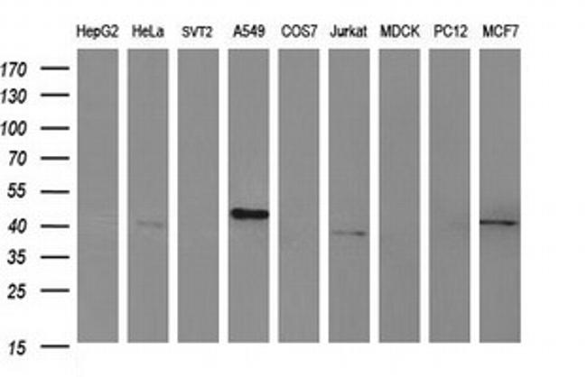 HAUS7 Antibody in Western Blot (WB)