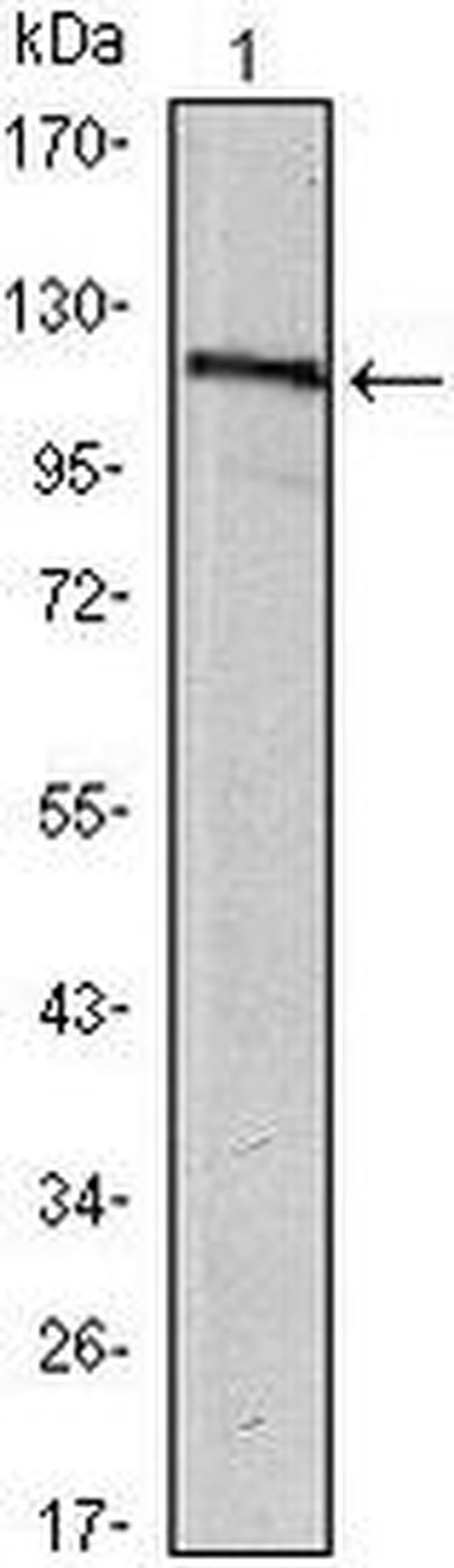 USP7 Antibody in Western Blot (WB)