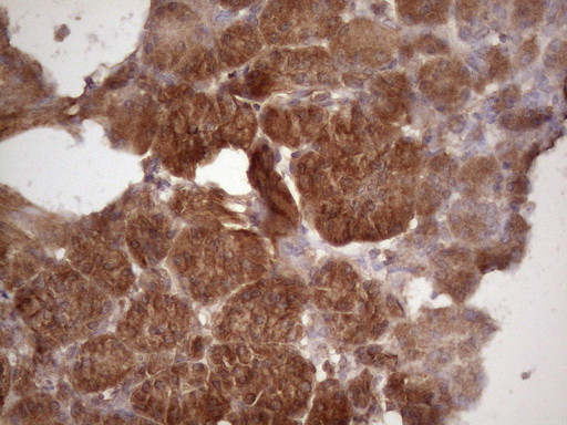 HAVCR2 Antibody in Immunohistochemistry (Paraffin) (IHC (P))