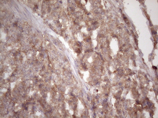 HAVCR2 Antibody in Immunohistochemistry (Paraffin) (IHC (P))