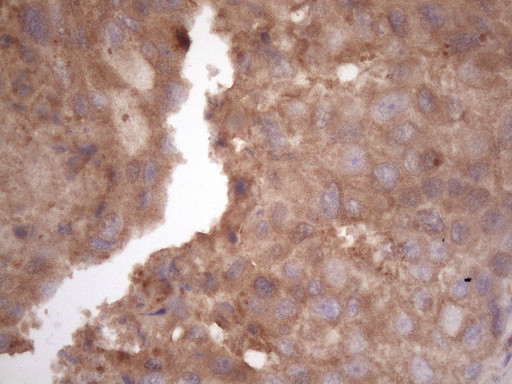 HAVCR2 Antibody in Immunohistochemistry (Paraffin) (IHC (P))