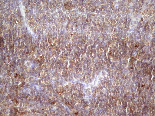 HAVCR2 Antibody in Immunohistochemistry (Paraffin) (IHC (P))