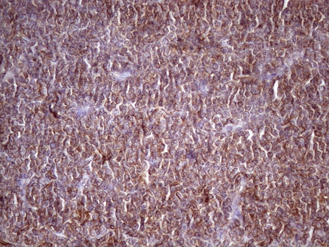 HAVCR2 Antibody in Immunohistochemistry (Paraffin) (IHC (P))