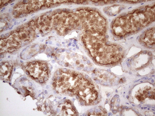 HAVCR2 Antibody in Immunohistochemistry (Paraffin) (IHC (P))