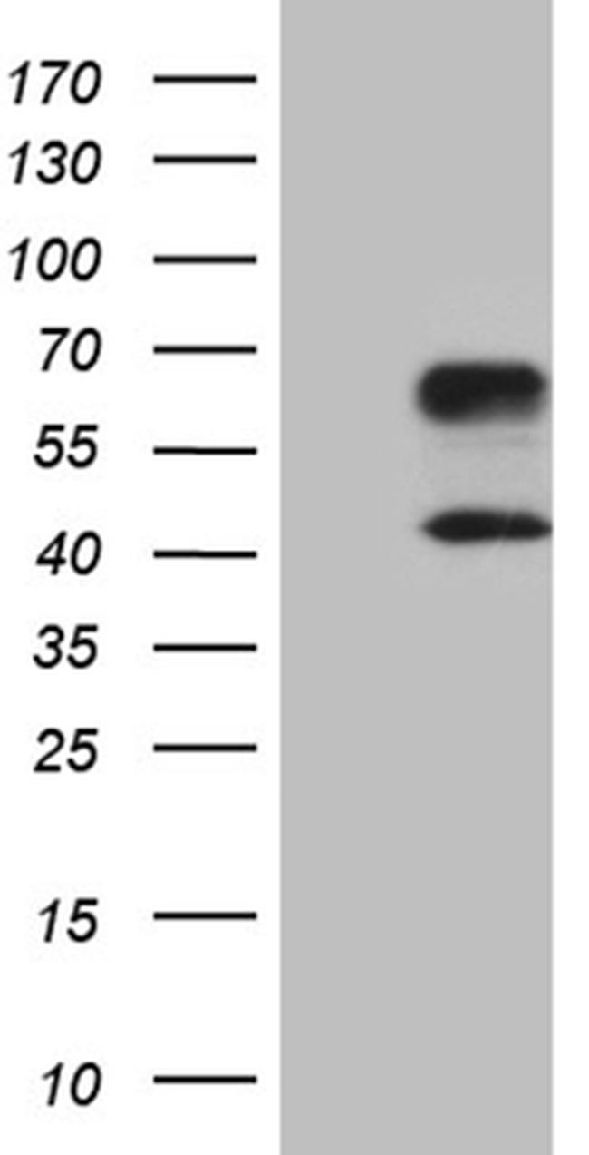 HAVCR2 Antibody in Western Blot (WB)