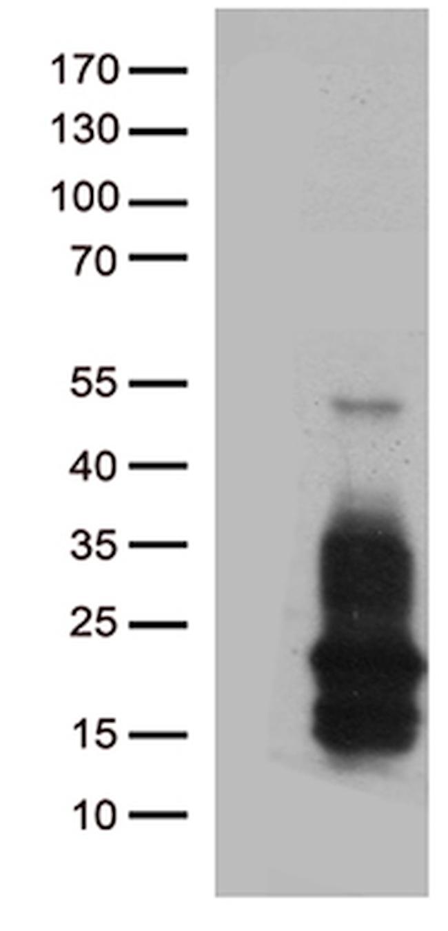 HBEGF Antibody in Western Blot (WB)