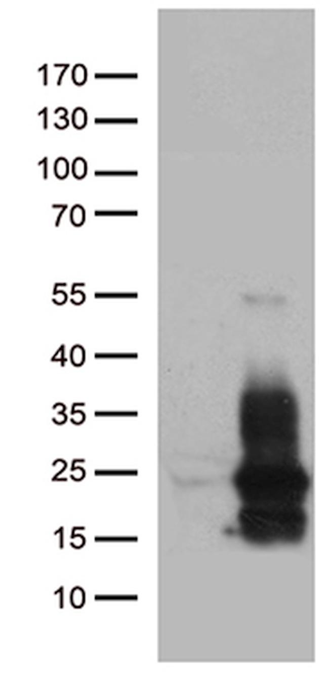 HBEGF Antibody in Western Blot (WB)