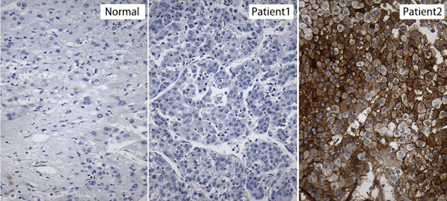 HBsAg Antibody in Immunohistochemistry (Paraffin) (IHC (P))