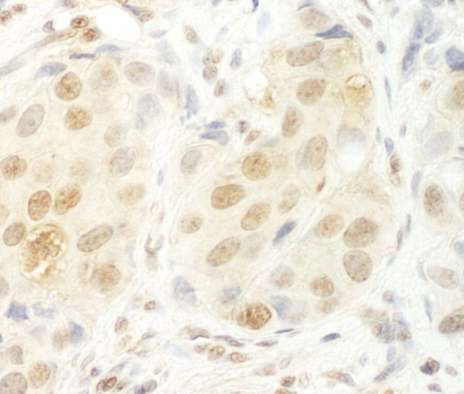 HCA66 Antibody in Immunohistochemistry (IHC)