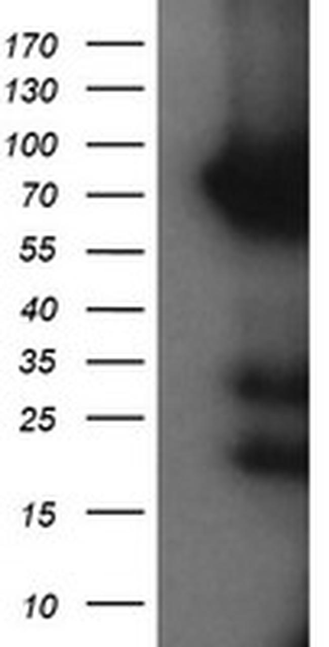 HCFC2 Antibody in Western Blot (WB)