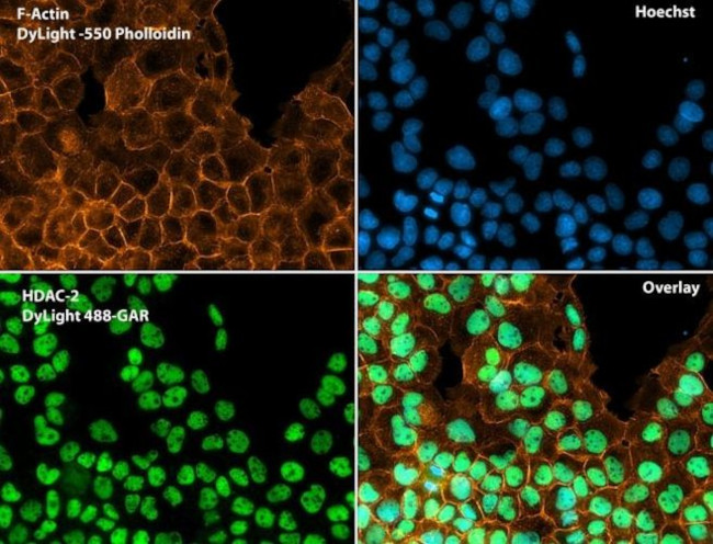 HDAC2 Antibody in Immunocytochemistry (ICC/IF)