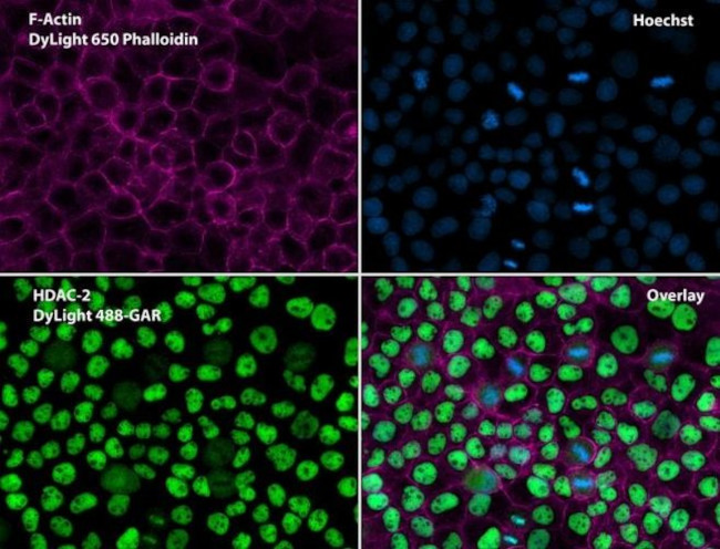 HDAC2 Antibody in Immunocytochemistry (ICC/IF)