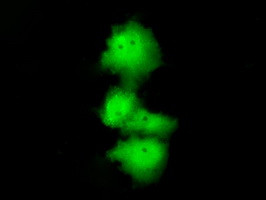 HDAC10 Antibody in Immunocytochemistry (ICC/IF)