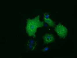 HDAC10 Antibody in Immunocytochemistry (ICC/IF)