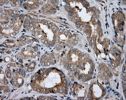 HDAC10 Antibody in Immunohistochemistry (Paraffin) (IHC (P))