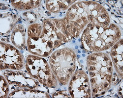 HDAC10 Antibody in Immunohistochemistry (Paraffin) (IHC (P))