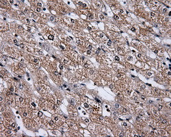 HDAC10 Antibody in Immunohistochemistry (Paraffin) (IHC (P))