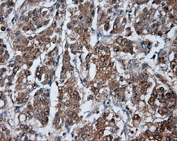 HDAC10 Antibody in Immunohistochemistry (Paraffin) (IHC (P))