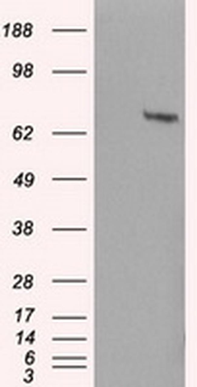 HDAC10 Antibody in Western Blot (WB)