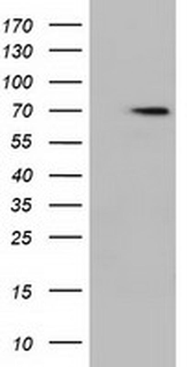 HDAC10 Antibody in Western Blot (WB)