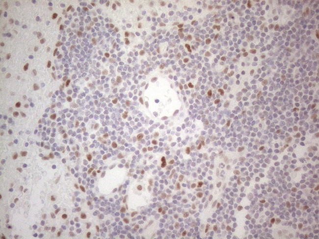 HDAC2 Antibody in Immunohistochemistry (Paraffin) (IHC (P))