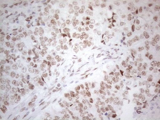 HDAC2 Antibody in Immunohistochemistry (Paraffin) (IHC (P))