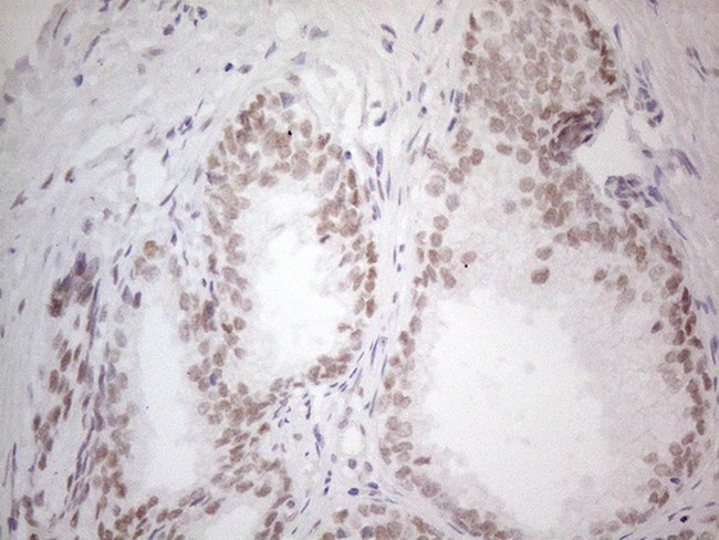 HDAC2 Antibody in Immunohistochemistry (Paraffin) (IHC (P))