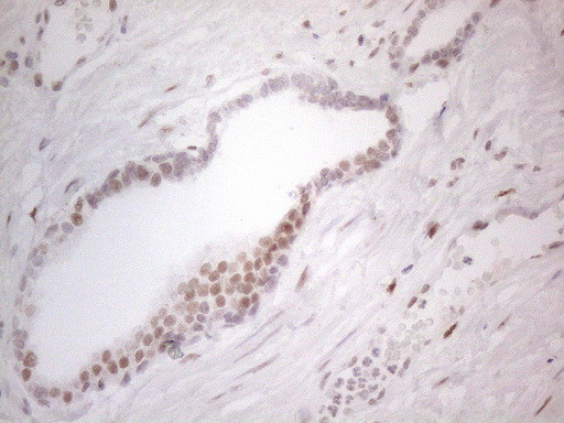 HDAC2 Antibody in Immunohistochemistry (Paraffin) (IHC (P))