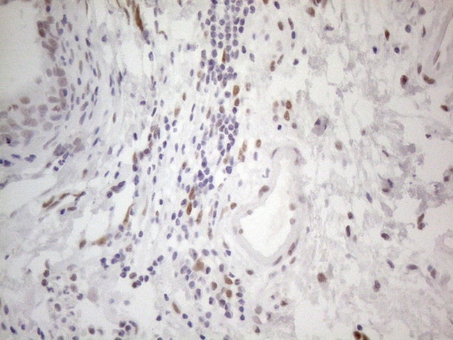 HDAC2 Antibody in Immunohistochemistry (Paraffin) (IHC (P))