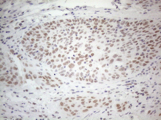 HDAC2 Antibody in Immunohistochemistry (Paraffin) (IHC (P))