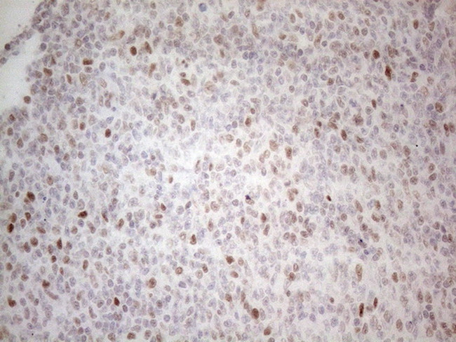 HDAC2 Antibody in Immunohistochemistry (Paraffin) (IHC (P))