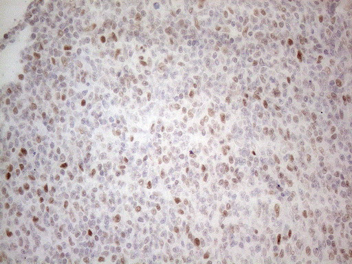 HDAC2 Antibody in Immunohistochemistry (Paraffin) (IHC (P))