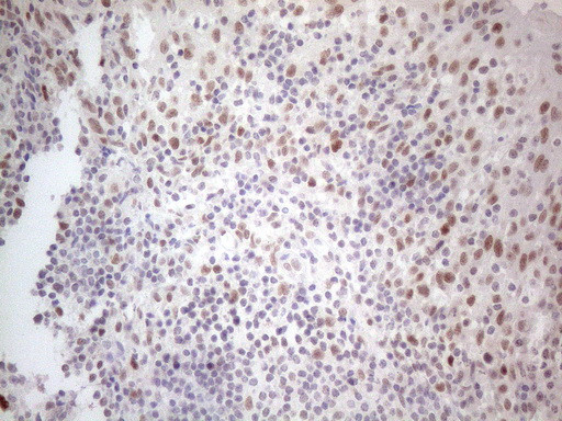 HDAC2 Antibody in Immunohistochemistry (Paraffin) (IHC (P))