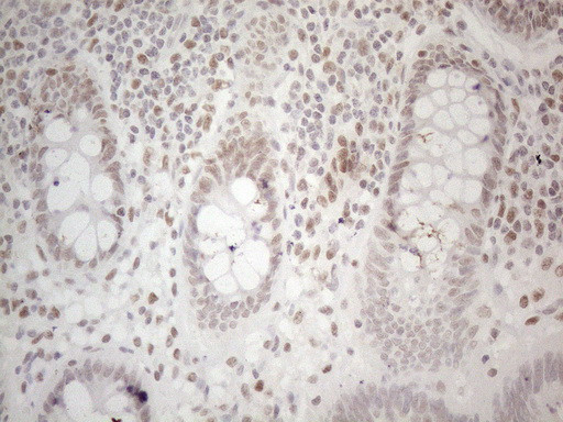 HDAC2 Antibody in Immunohistochemistry (Paraffin) (IHC (P))