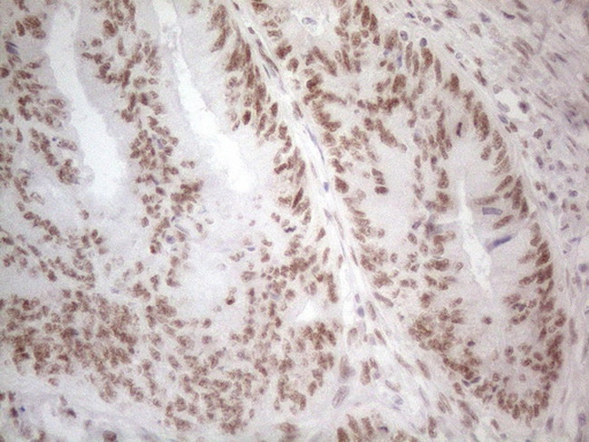 HDAC2 Antibody in Immunohistochemistry (Paraffin) (IHC (P))