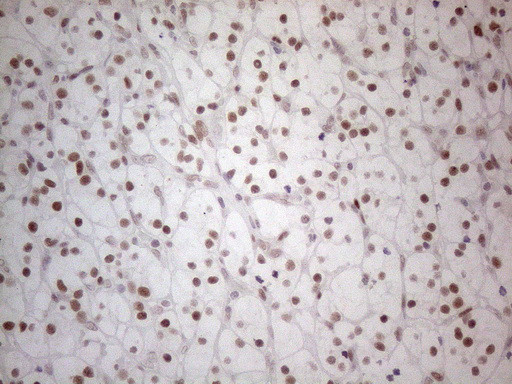 HDAC2 Antibody in Immunohistochemistry (Paraffin) (IHC (P))