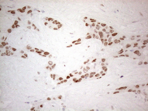 HDAC2 Antibody in Immunohistochemistry (Paraffin) (IHC (P))