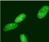 HDAC2 Antibody in Immunocytochemistry (ICC/IF)