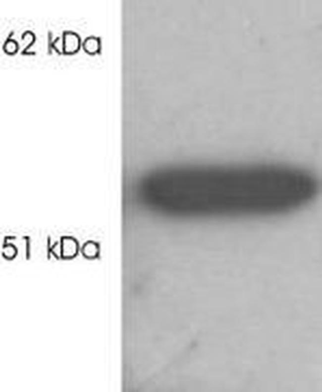 HDAC2 Antibody in Western Blot (WB)