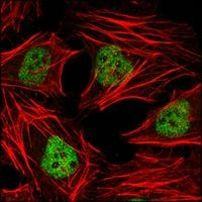 HDAC3 Antibody in Immunocytochemistry (ICC/IF)