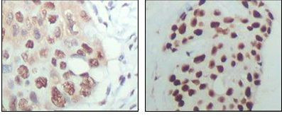 HDAC3 Antibody in Immunohistochemistry (Paraffin) (IHC (P))