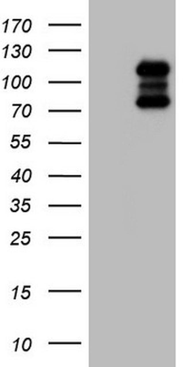 HDAC4 Antibody in Western Blot (WB)