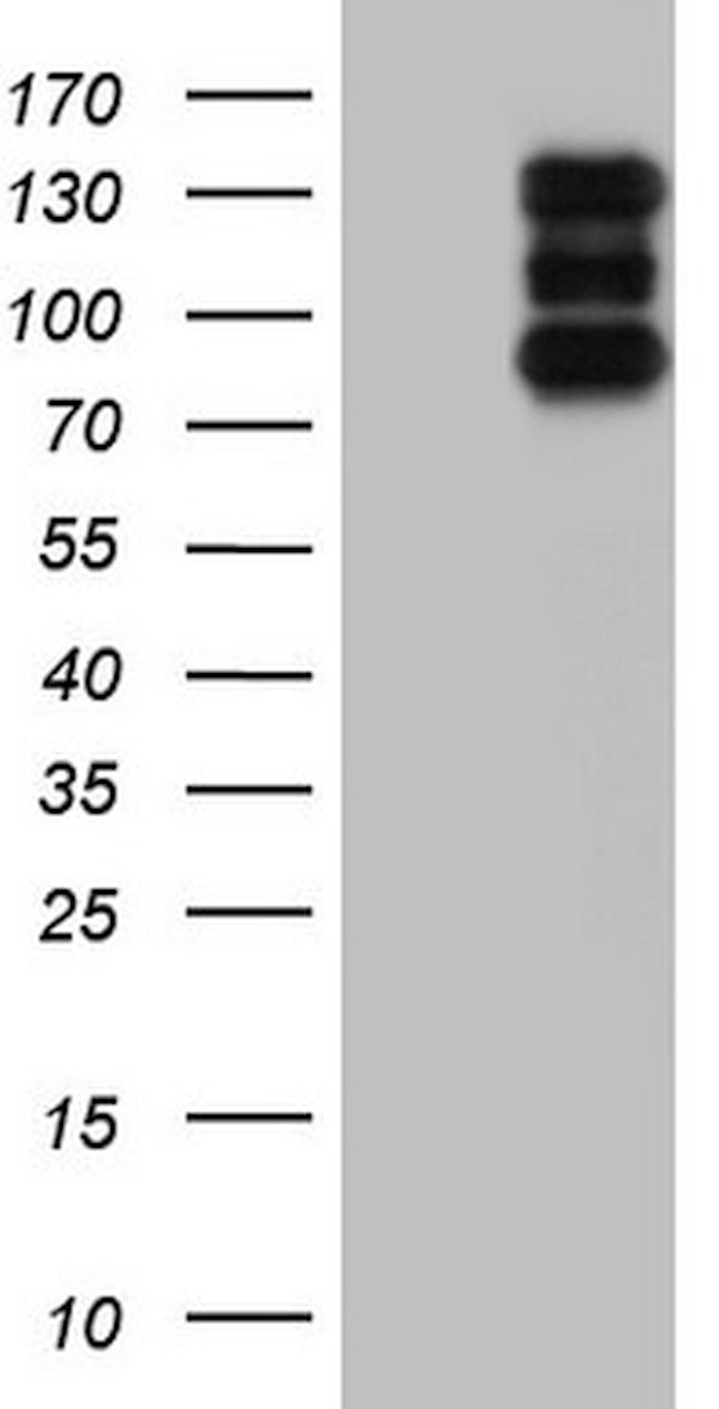 HDAC4 Antibody in Western Blot (WB)