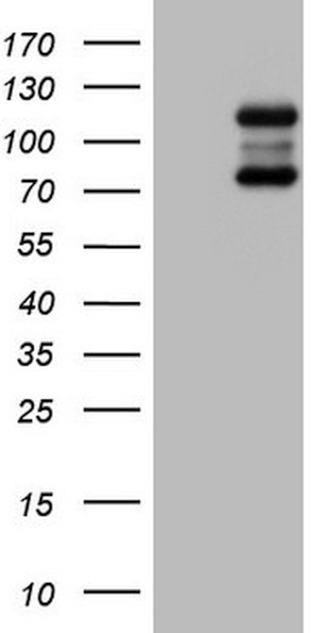 HDAC4 Antibody in Western Blot (WB)