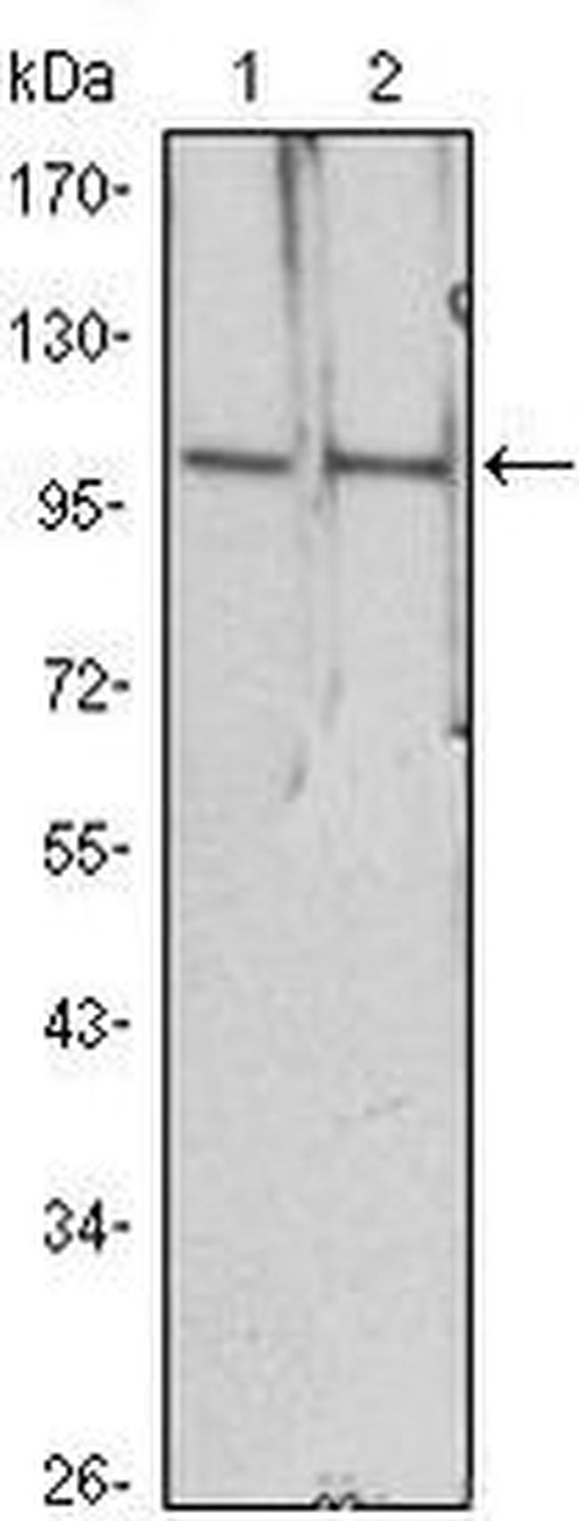 HDAC4 Antibody in Western Blot (WB)