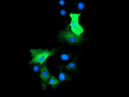 HDAC6 Antibody in Immunocytochemistry (ICC/IF)