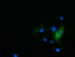 HDAC6 Antibody in Immunocytochemistry (ICC/IF)