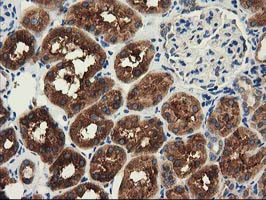 HDAC6 Antibody in Immunohistochemistry (Paraffin) (IHC (P))